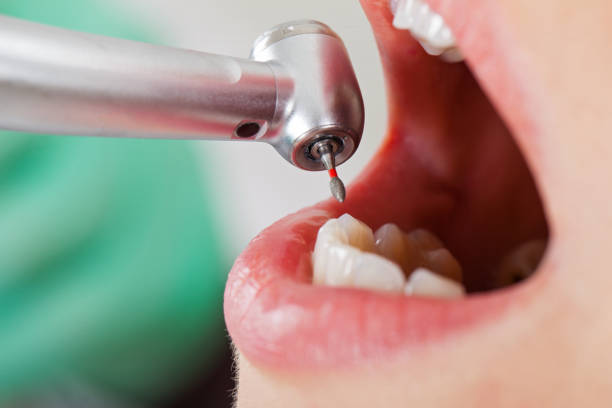 Best Tooth Pain Emergency Relief  in Rock Hall, MD